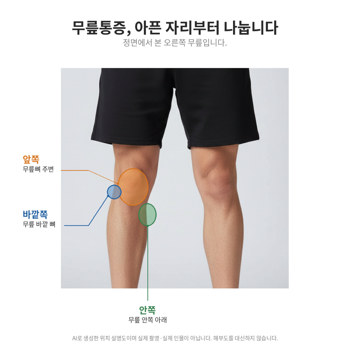 정면에서 본 오른쪽 무릎 그림에 앞쪽·바깥쪽·안쪽 세 부위가 각각 다른 색으로 표시된 위치 설명도